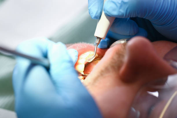 Best Cracked Tooth Emergency Dentist  in Beach Park, IL